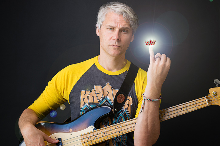 Picture of Gio showing his pinky that has a shiny crown on top of it